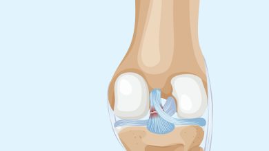 Lesão do LCP a lesão esquecida que pode deixar seu joelho instável