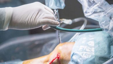 Sutura do menisco quando ela é indicada