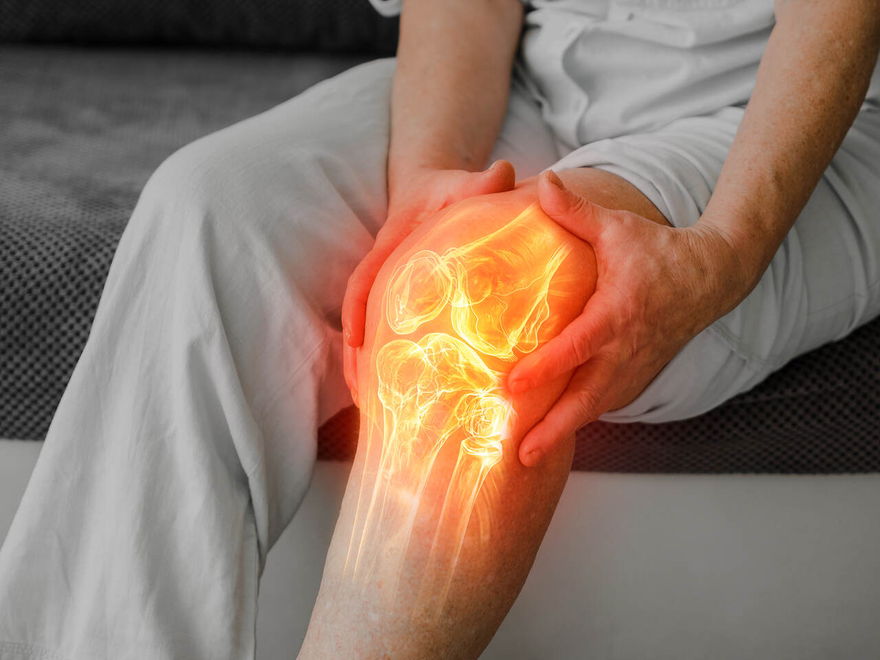 Artrose no joelho Veja quando pode ser hora de pensar em uma prótese