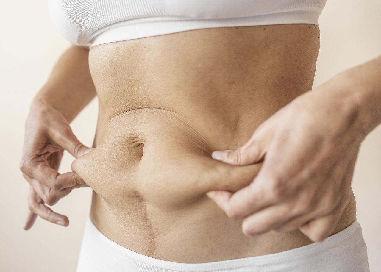 Se o medo da abdominoplastia vem do que você ouviu por aí, este post é pra você